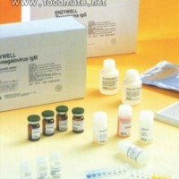 白细胞分化抗原30(CD30)ELISA试剂盒【酶联免疫法】