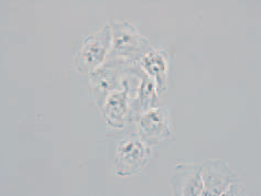 IX3 HeLa细胞1
