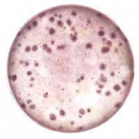 霉菌酵母菌