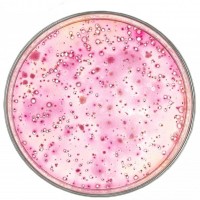 食品微生物大肠菌群（VRBA）检测