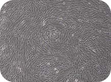 人脐带间充质干细胞复苏的细胞形态图72h