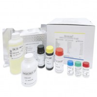 西尼罗河病毒IgG检测试剂盒